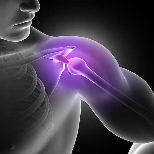 Tendinosis Treatment